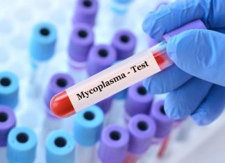 Cele mai eficiente metode de prevenire a infecției cu Mycoplasma