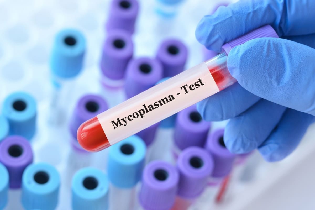 Cele mai eficiente metode de prevenire a infecției cu Mycoplasma